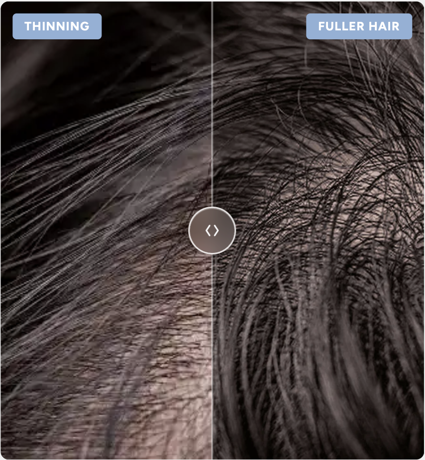 Less hair fall by week two to three